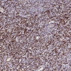 Anti-ZNF559 Antibody
