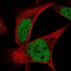 Immunofluorescent staining of human cell line RH-30 shows localization to nucleoplasm.
