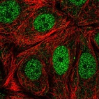 Anti-CDK10 Antibody