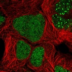 Anti-ZNF32 Antibody