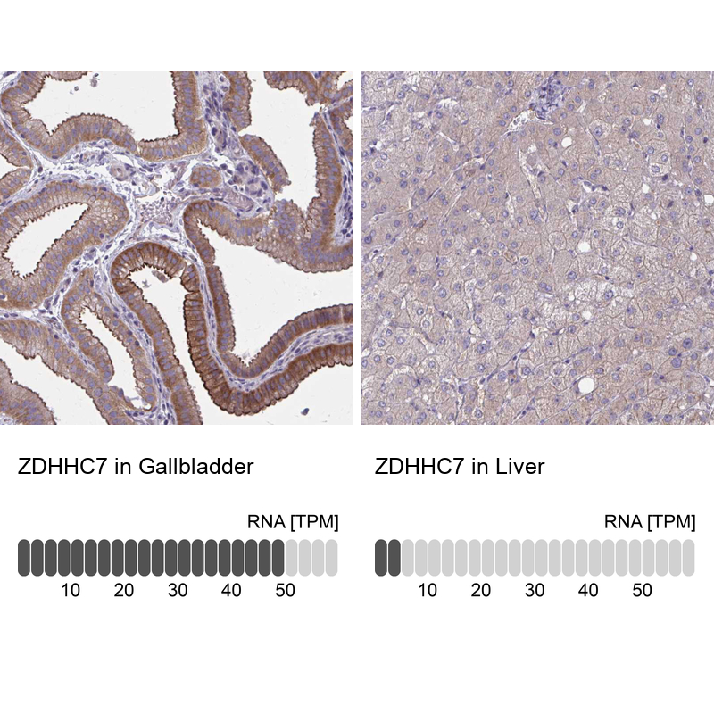 Anti-ZDHHC7 Antibody