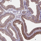 Immunohistochemical staining of human gallbladder shows strong membranous and cytoplasmic positivity in glandular cells.