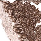 Immunohistochemical staining of human stomach shows strong membranous positivity in glandular cells.