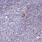 Anti-ZDHHC7 Antibody