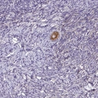 Immunohistochemical staining of human ovary shows strong membranous and cytoplasmic positivity in follicle cells.
