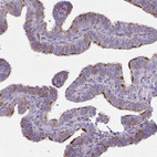 Anti-ZDHHC7 Antibody