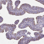 Immunohistochemical staining of human fallopian tube shows strong positivity in cilia and membrane in glandular cells.
