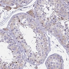Immunohistochemical staining of human testis shows moderate cytoplasmic positivity in cells in seminiferous ducts.