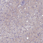 Immunohistochemical staining of human liver shows very weak membranous and cytoplasmic positivity in hepatocytes.