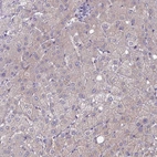 Immunohistochemical staining of human liver shows very weak membranous and cytoplasmic positivity in hepatocytes.