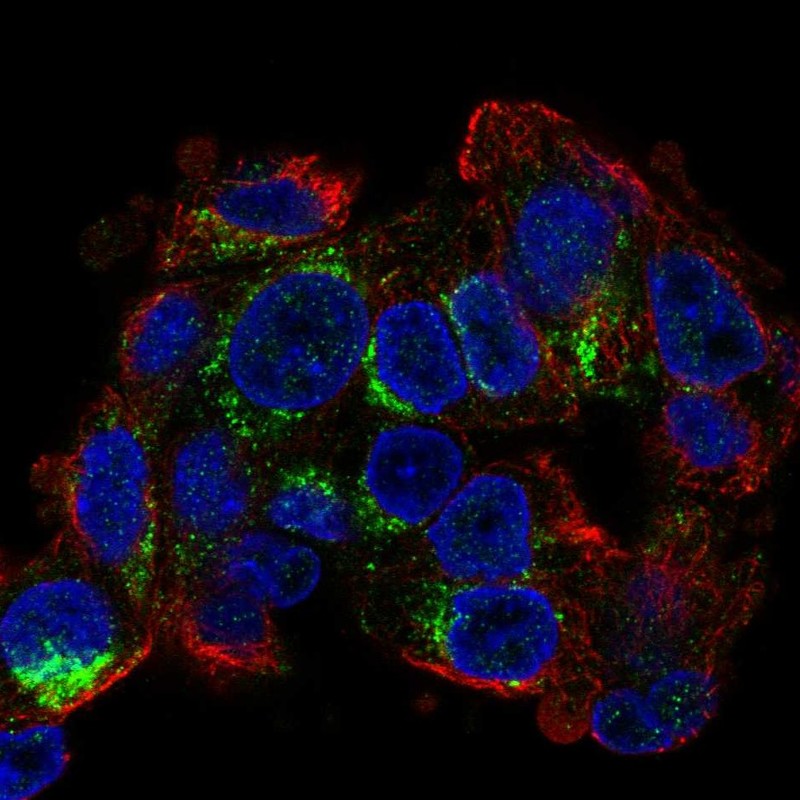 Anti-CIDEB Antibody