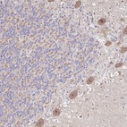 Anti-HCFC1R1 Antibody