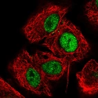Immunofluorescent staining of human cell line A549 shows localization to nucleoplasm.
