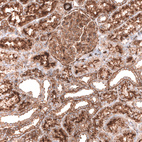 Anti-IGFBP2 Antibody