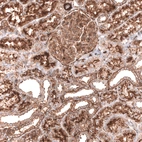 Immunohistochemical staining of human kidney shows strong membranous positivity in cells in tubules and cells in glomeruli with additional cytoplasmic positivity.