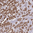 Anti-DTX3 Antibody