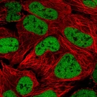 Immunofluorescent staining of human cell line HEK 293 shows localization to nucleoplasm.