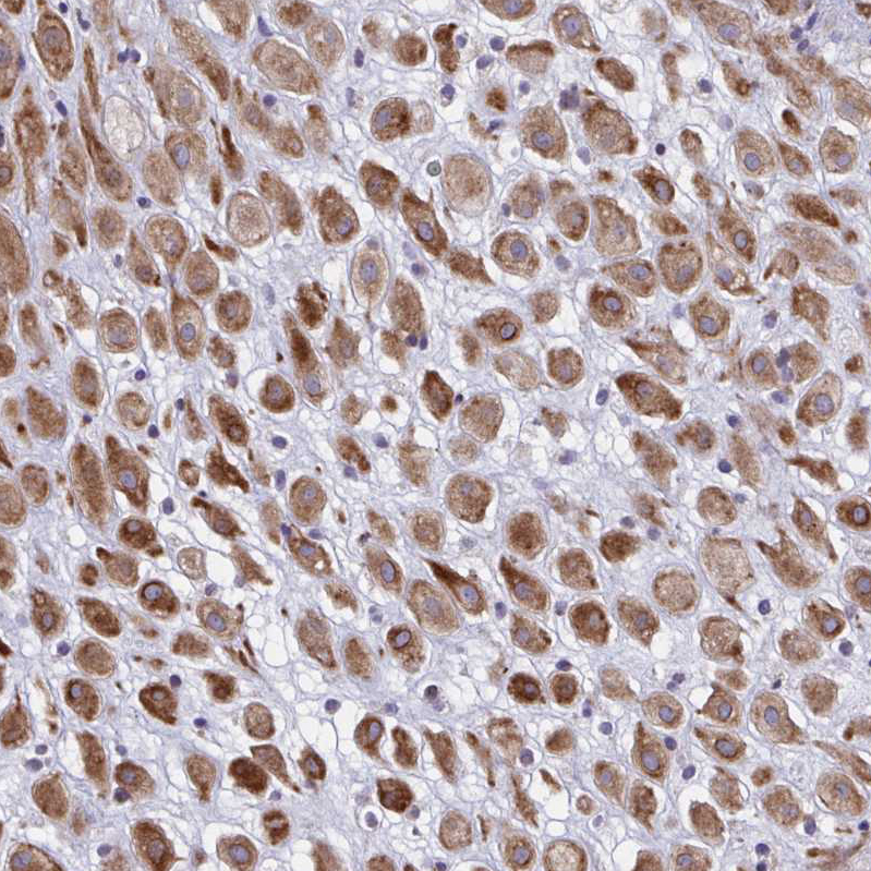 Anti-DCBLD1 Antibody