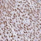 Anti-DCBLD1 Antibody