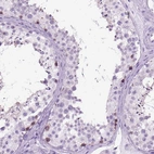 Immunohistochemical staining of human testis shows high expression.