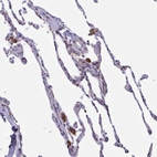 Immunohistochemical staining of human lung shows moderate cytoplasmic positivity in macrophages.