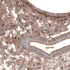Immunohistochemical staining of human endometrium shows moderate membranous positivity in glandular cells and endometrial stromal cells.
