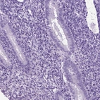 Immunohistochemical staining of human endometrium shows low expression as expected.