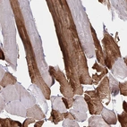 Immunohistochemical staining of human skeletal muscle shows strong cytoplasmic positivity in myocytes.