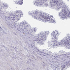 Immunohistochemical staining of human prostate shows no cytoplasmic positivity in glandular cells as expected.
