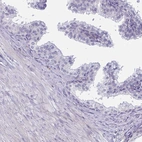 Immunohistochemical staining of human prostate shows no cytoplasmic positivity in glandular cells as expected.