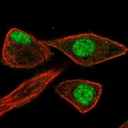 Anti-ZNF784 Antibody