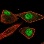 Immunofluorescent staining of human cell line PC-3 shows localization to nucleus.