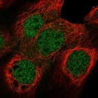 Anti-NUF2 Antibody