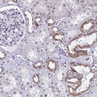 Immunohistochemical staining of human kidney shows moderate positivity in nuclear membrane in cells in tubules.