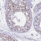 Immunohistochemical staining of human testis shows moderate positivity in nuclear membrane in cells in seminiferous ducts.