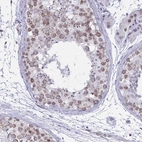 Immunohistochemical staining of human testis shows moderate positivity in nuclear membrane in cells in seminiferous ducts.