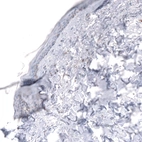 Immunohistochemical staining of human skin shows negative to very weak positivity in squamous epithelial cells.