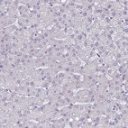 Immunohistochemical staining of human liver shows no positivity in hepatocytes as expected.