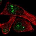 Immunofluorescent staining of human cell line RH-30 shows localization to nucleoli & nuclear membrane.