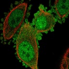 Anti-C19orf33 Antibody