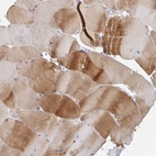 Immunohistochemical staining of human skeletal muscle shows high expression.