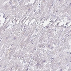 Immunohistochemical staining of human heart muscle shows low expression as expected.