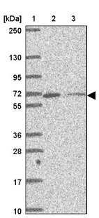 Lane 1: Marker [kDa] 250, 130, 95, 72, 55, 36, 28, 17, 10_br/_Lane 2: Human cell line RT-4_br/_Lane 3: Human cell line U-251MG sp