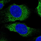 Immunofluorescent staining of human cell line U-2 OS shows localization to endoplasmic reticulum.