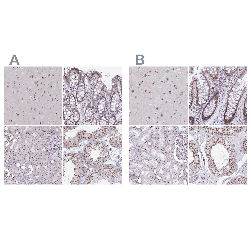 Anti-PUF60 Antibody