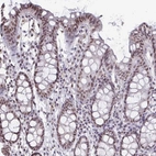Immunohistochemical staining of human colon shows strong nuclear positivity in glandular cells.