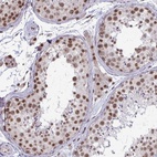 Immunohistochemical staining of human testis shows high expression.