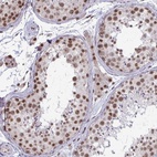 Anti-PUF60 Antibody