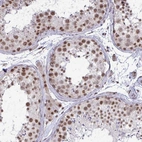 Immunohistochemical staining of human testis shows strong nuclear positivity in cells in seminiferous ducts.