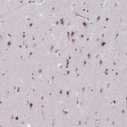 Immunohistochemical staining of human cerebral cortex shows strong nuclear positivity in neurons.